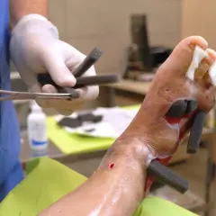 Kanarek kuleje? Leczenie łapek, odciski, pododermatitis!