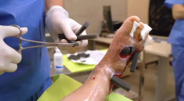 Kanarek kuleje? Leczenie łapek, odciski, pododermatitis!